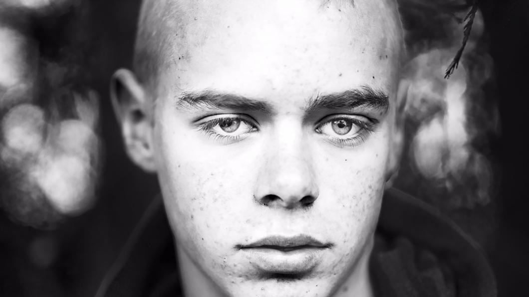 foto van Joeri Pels – copyright Linelle Deunk. Joeri is meer dan 150 keer in het ziekenhuis geweest. 